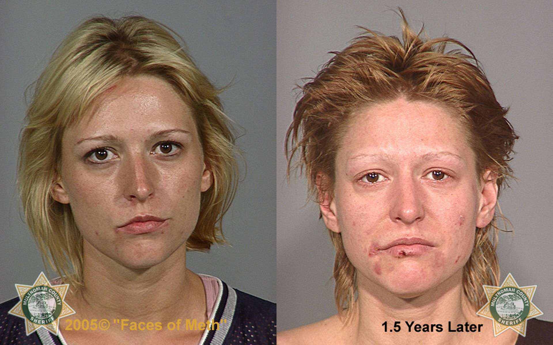 Faces of Meth Female. Photograph published with thanks to the Multnomah County Sheriff's Office. Copyright Faces of Meth ® 2005