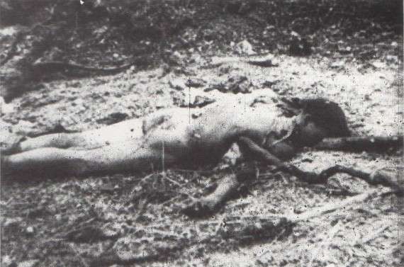 Αμερικάνος στρατιώτης με κομμένο χέρι – φωτογραφία λογοκριμένη για το μεγαλύτερο μέρος του πολέμου.
